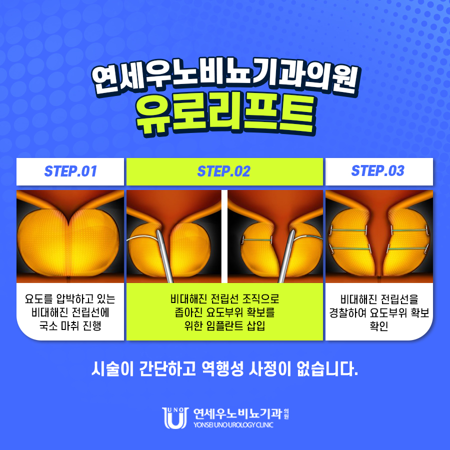 강남 잠실 전립선비대증 진료 병원 연세우노비뇨기과